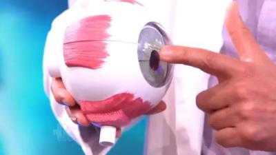 A terrible baseball eye injury explained