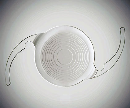 Intraocular Lens (IOLS), AGEI