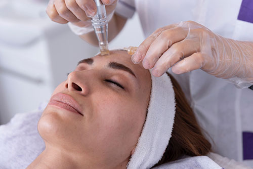 Microneedling, Assil Eye Institute, Los Angeles