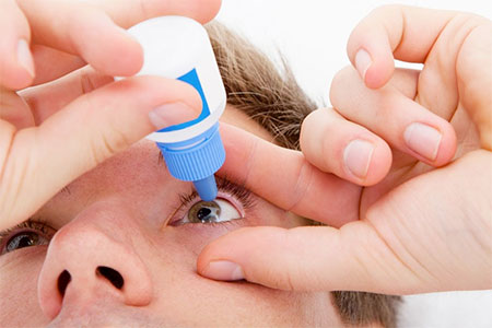 Dry Eye Patient Image