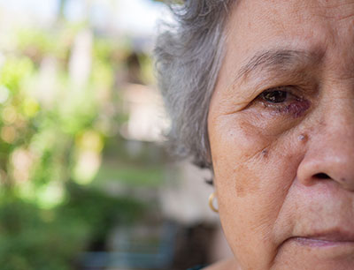 Woman with blocked tear duct